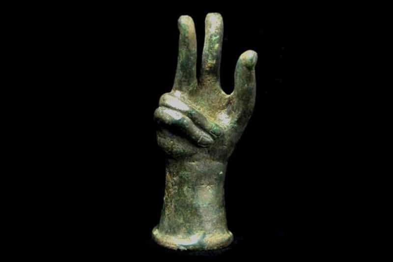 origine maladie dupuytren main - main de Sabazios avec rétraction doigts