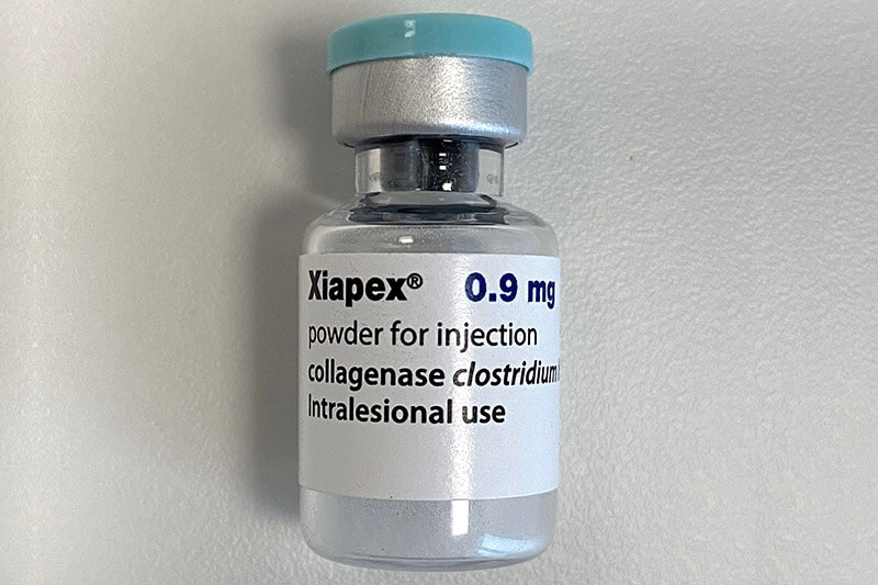maladie de dupuytren traitement naturel - injection collagenase aiguille - Xiapex